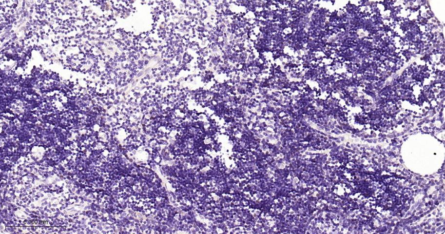 DNA甲基转移酶1重组兔单抗