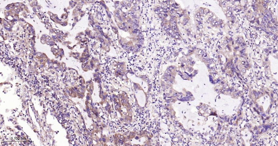 腺苷单磷酸活化蛋白激酶α1重组兔单抗
