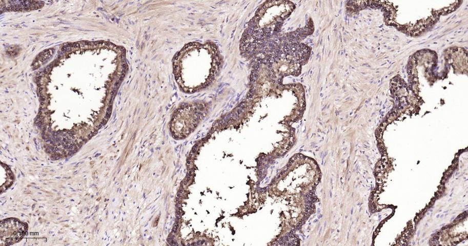 异柠檬酸脱氢酶1重组兔单抗
