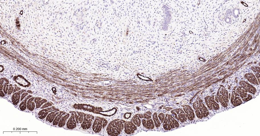 平滑肌肌球蛋白重链抗体
