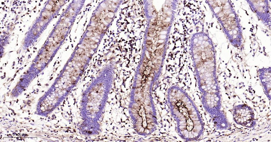 粘蛋白-1重组兔单抗