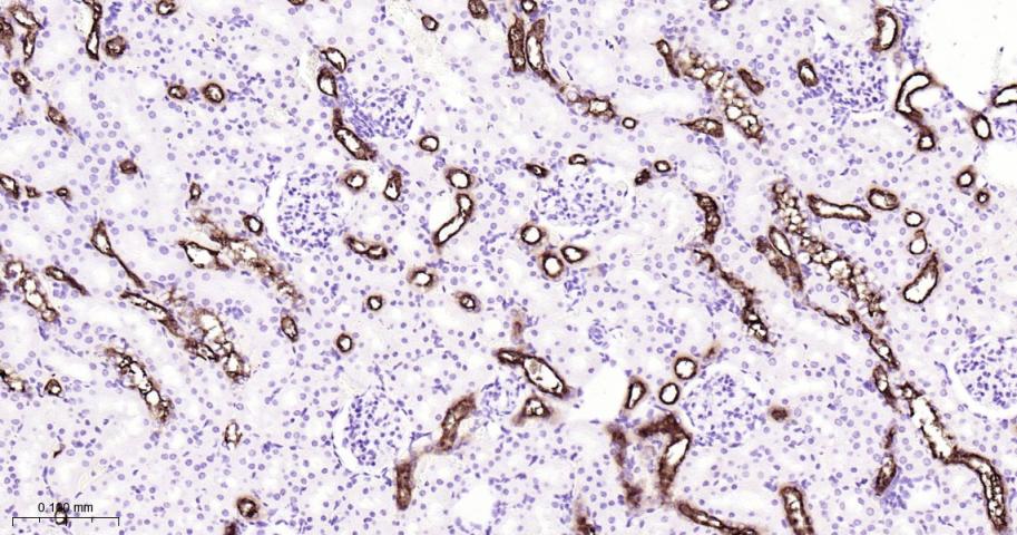 粘蛋白-1重组兔单抗