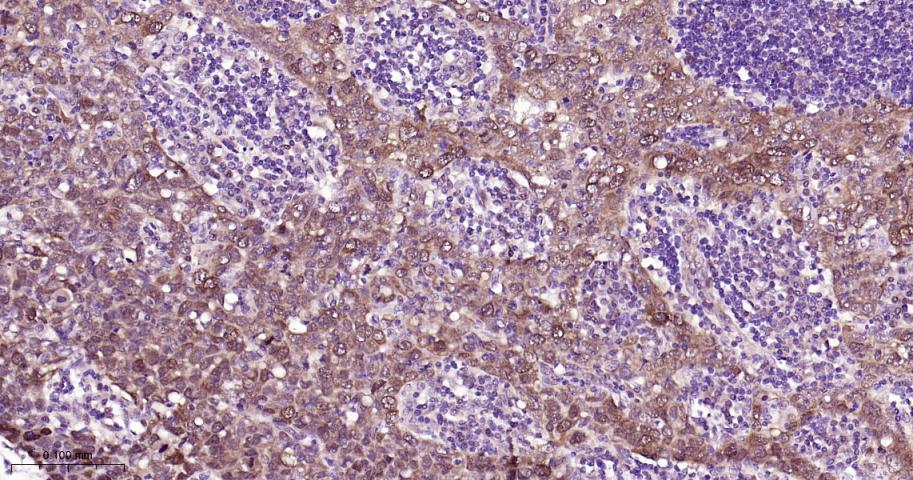 周期素依赖性激酶4重组兔单抗