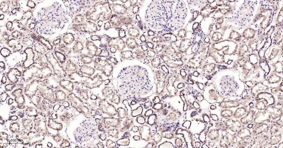 热休克蛋白10/HSPE1重组兔单抗