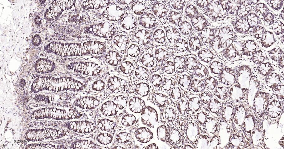 热休克蛋白10/HSPE1重组兔单抗