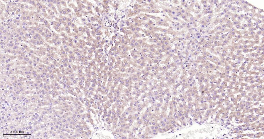 腺苷单磷酸活化蛋白激酶α1重组兔单抗