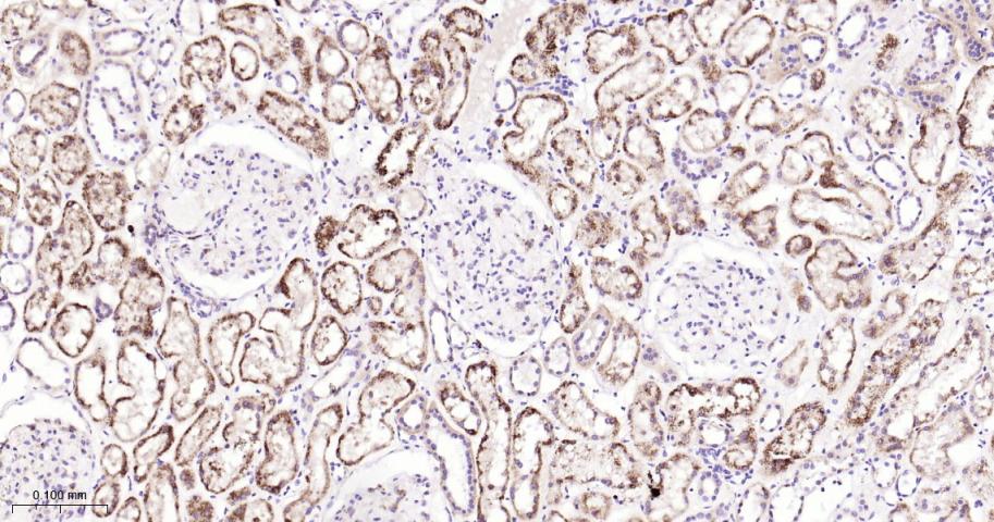 葡萄糖调节蛋白94重组兔单抗
