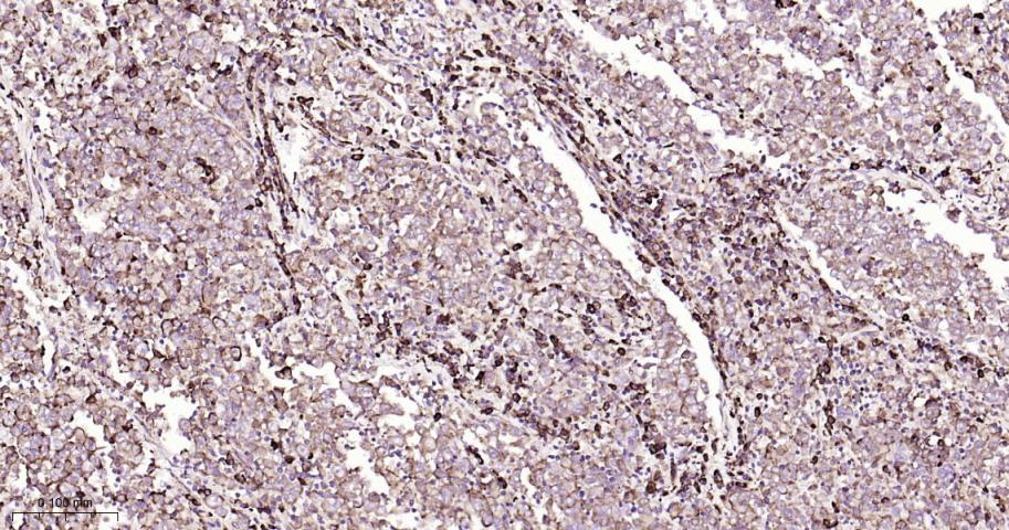 葡萄糖调节蛋白94重组兔单抗