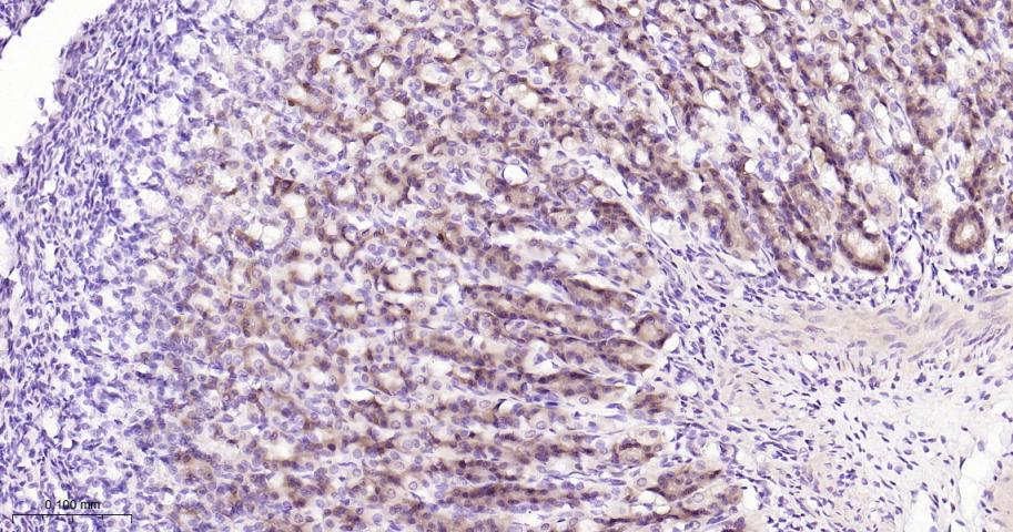 葡萄糖调节蛋白94重组兔单抗