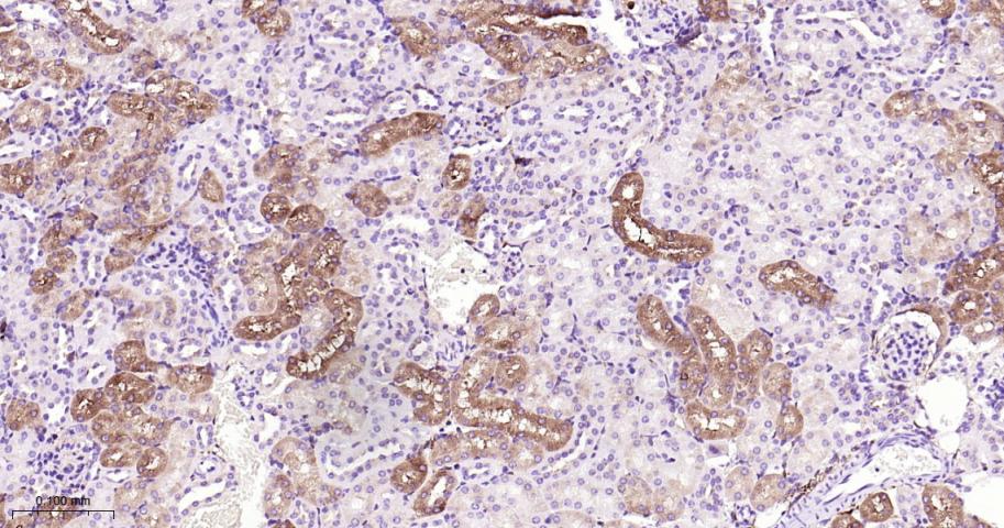 蛋白质酪氨酸激酶JAK-1重组兔单抗