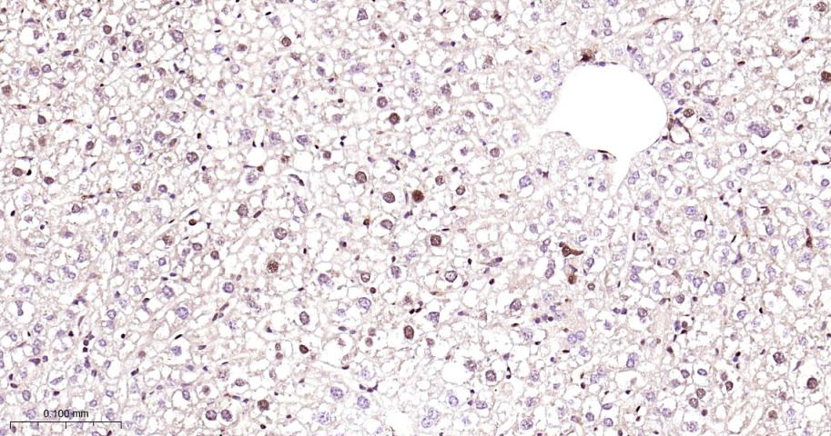 周期素依赖性激酶4重组兔单抗