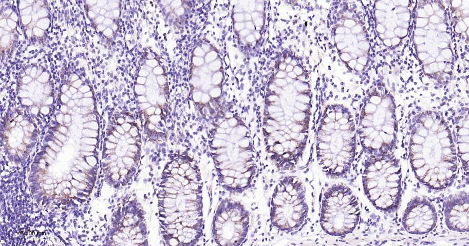 蛋白质酪氨酸激酶JAK-1重组兔单抗