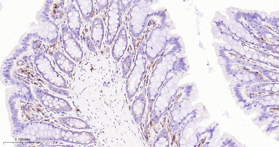 蛋白质酪氨酸激酶JAK-1重组兔单抗