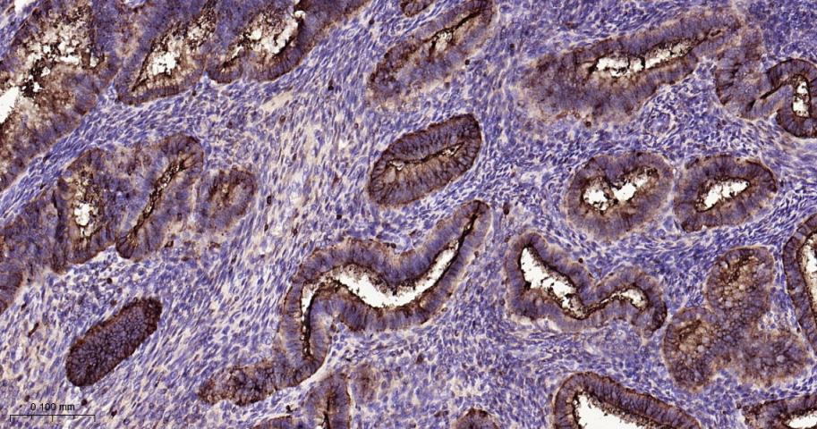 粘蛋白-1重组兔单抗