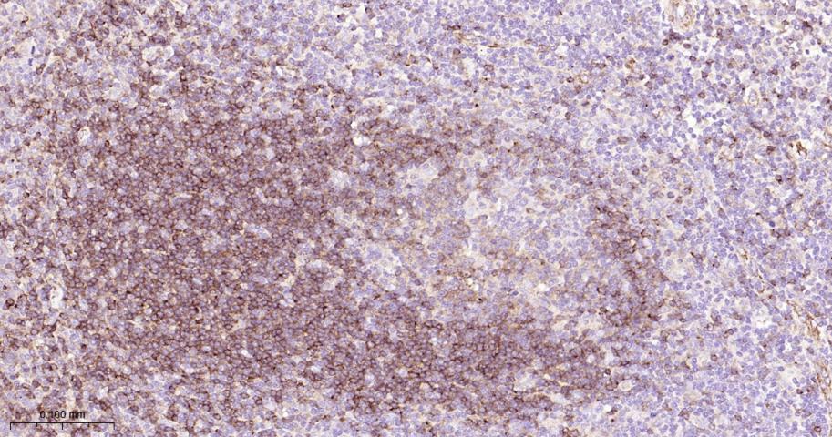 B淋巴细胞粘附分子CD22重组兔单抗