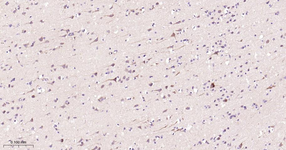 腺苷单磷酸活化蛋白激酶α1重组兔单抗