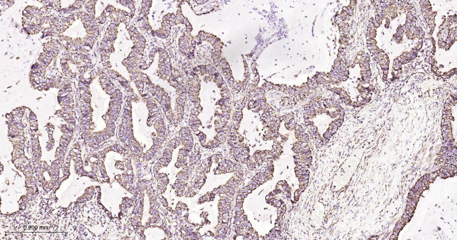 热休克蛋白10/HSPE1重组兔单抗