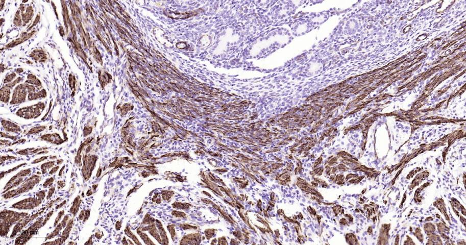 平滑肌肌球蛋白重链抗体