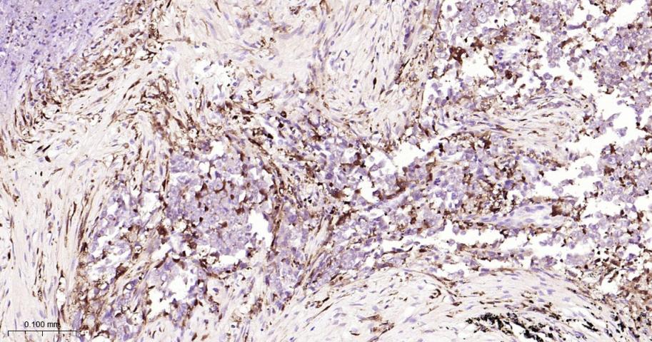 FC段γ受体3/免疫球蛋白G Fc段受体III重组兔单抗