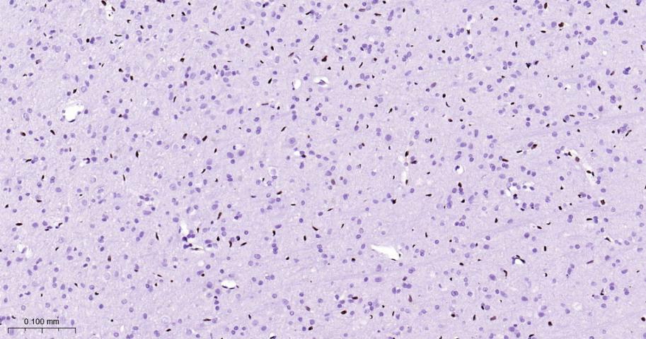 癌基因ERG重组兔单抗