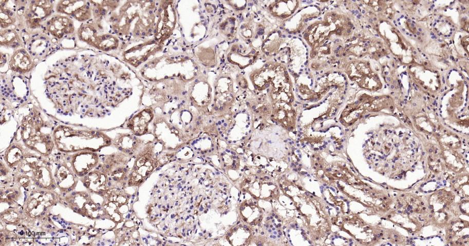 异柠檬酸脱氢酶1重组兔单抗