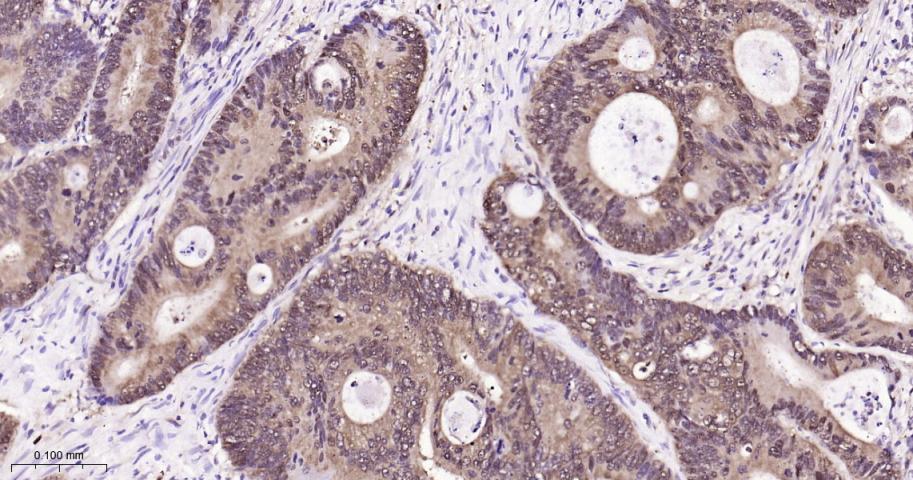 异柠檬酸脱氢酶1重组兔单抗
