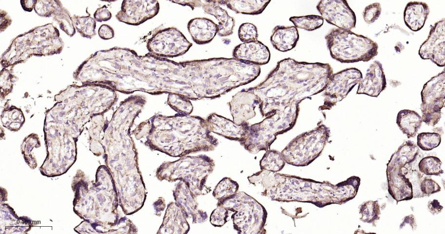 葡萄糖调节蛋白94重组兔单抗
