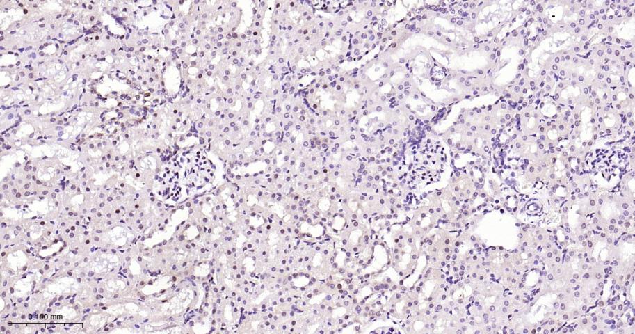周期素依赖性激酶4重组兔单抗