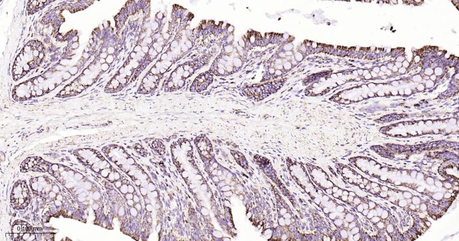 热休克蛋白10/HSPE1重组兔单抗