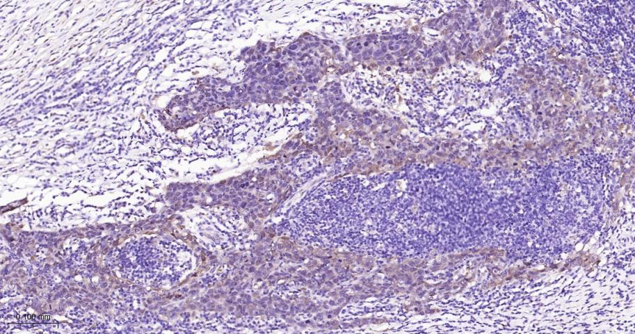 异柠檬酸脱氢酶1重组兔单抗