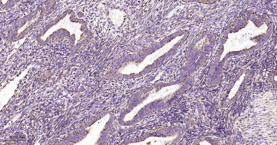 热休克蛋白10/HSPE1重组兔单抗