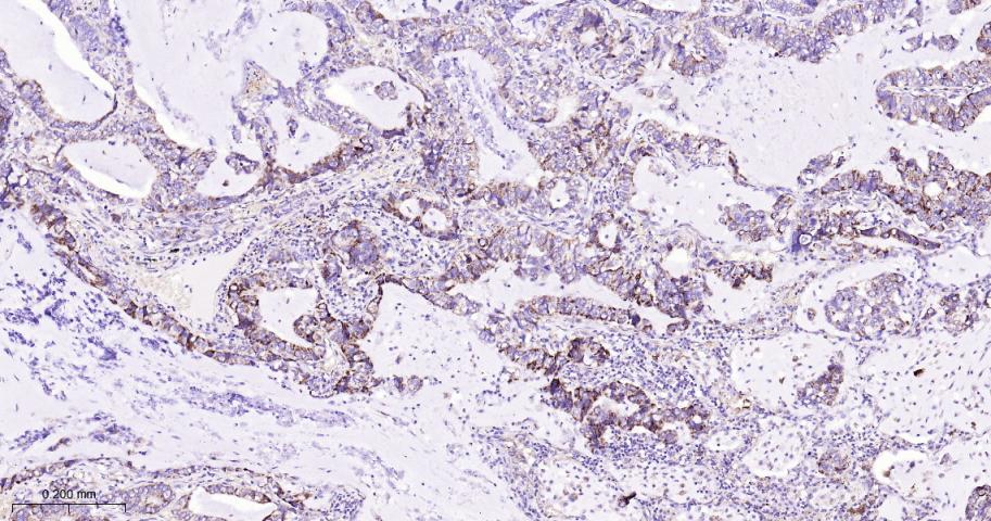 蛋白质酪氨酸激酶JAK-1重组兔单抗