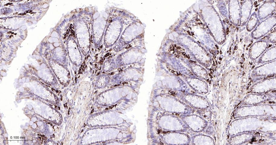 葡萄糖调节蛋白94重组兔单抗