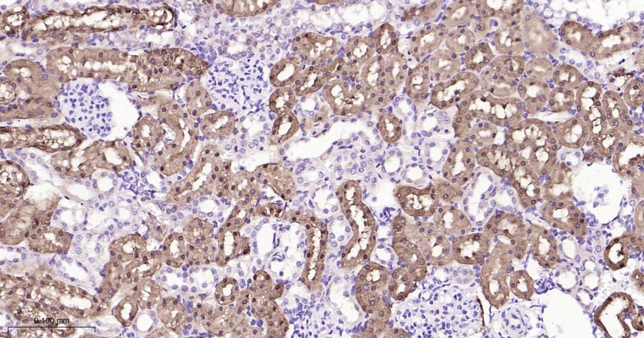 异柠檬酸脱氢酶1重组兔单抗