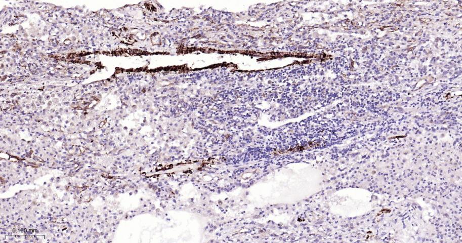 平滑肌肌球蛋白重链抗体