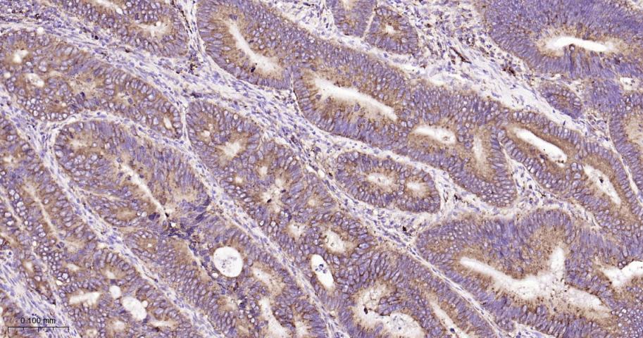 葡萄糖调节蛋白94重组兔单抗