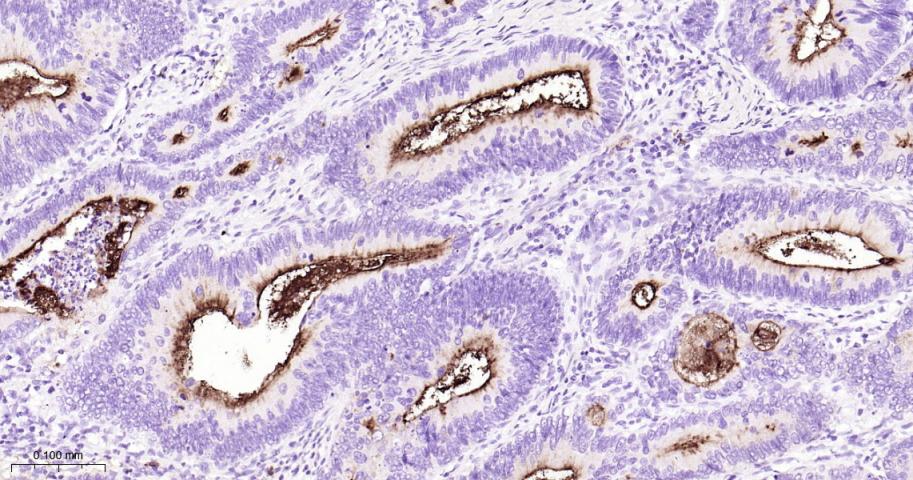 粘蛋白-1重组兔单抗