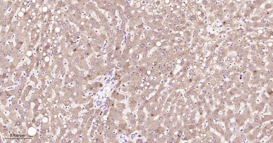 异柠檬酸脱氢酶1重组兔单抗