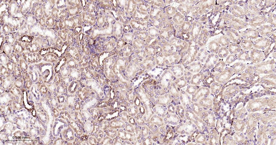 葡萄糖调节蛋白94重组兔单抗