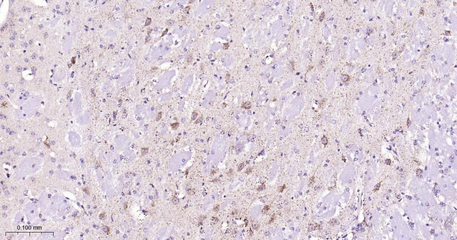 热休克蛋白10/HSPE1重组兔单抗