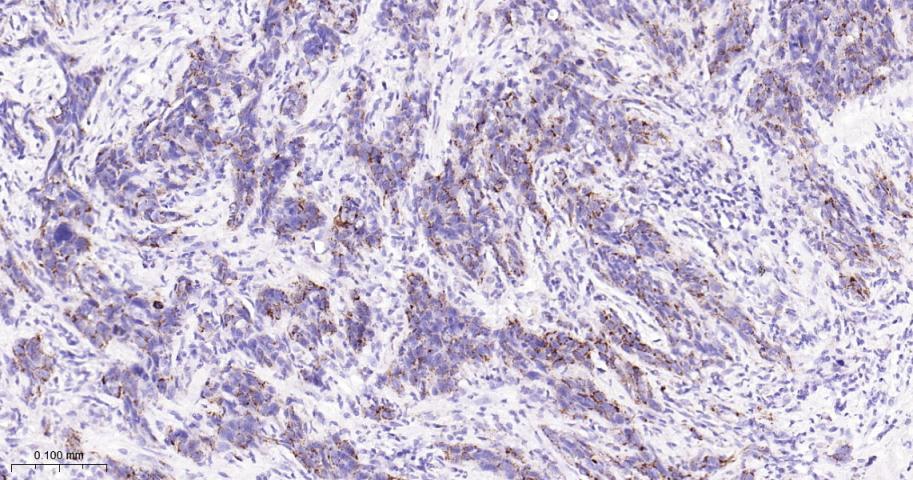 蛋白质酪氨酸激酶JAK-1重组兔单抗