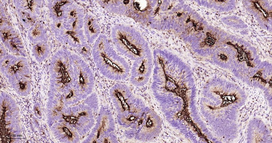 粘蛋白-1重组兔单抗
