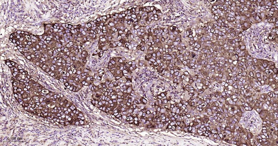 粘蛋白-1重组兔单抗