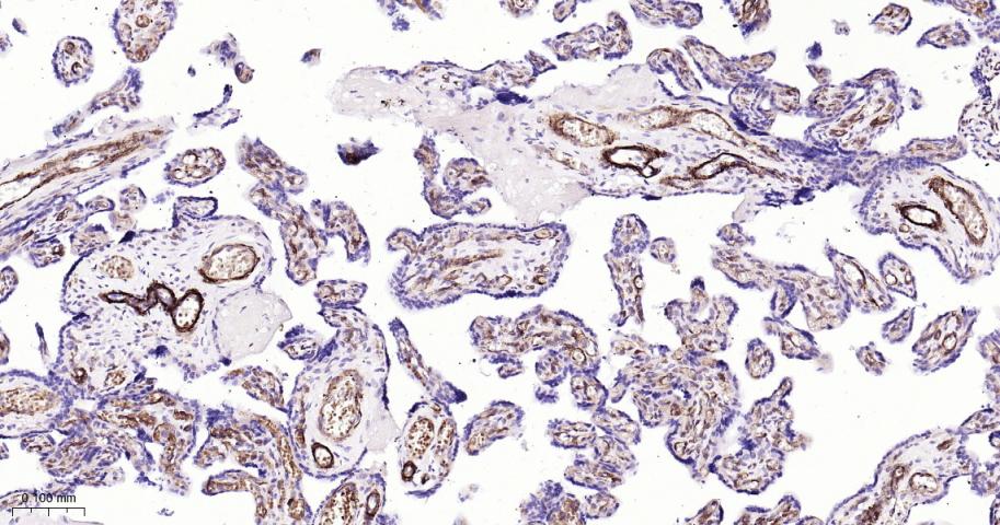 平滑肌肌球蛋白重链抗体
