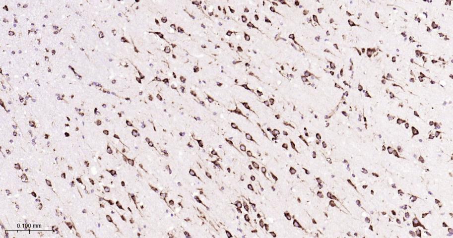 葡萄糖调节蛋白94重组兔单抗