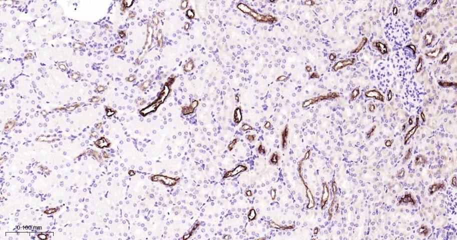 粘蛋白-1重组兔单抗