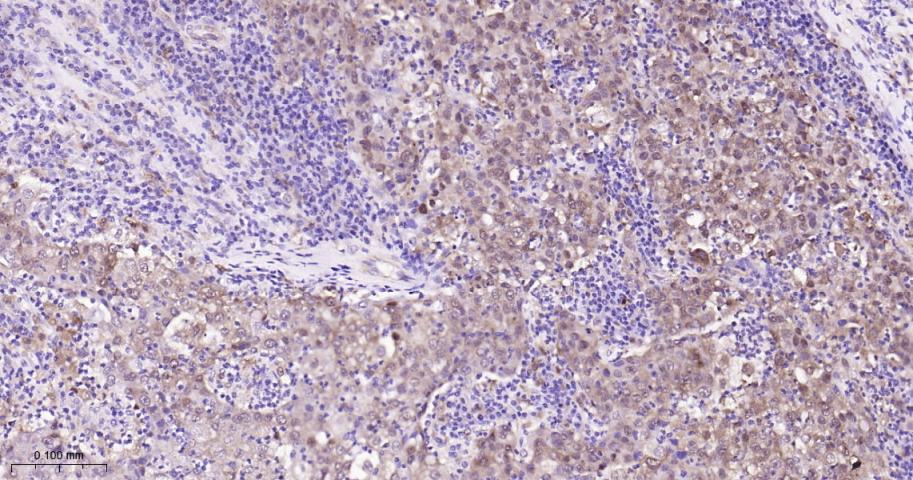 异柠檬酸脱氢酶1重组兔单抗