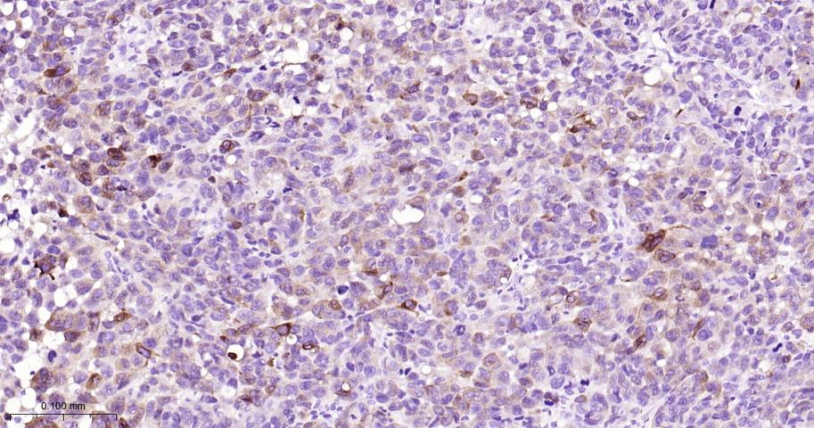 黑色素瘤相关抗原/黑色素-A重组兔单抗