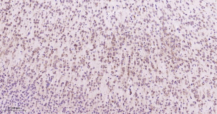 葡萄糖调节蛋白94重组兔单抗