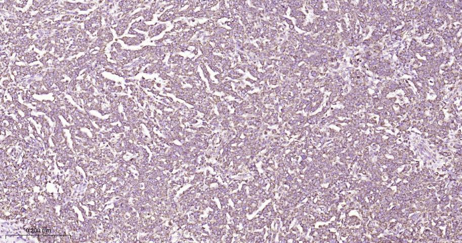 热休克蛋白10/HSPE1重组兔单抗